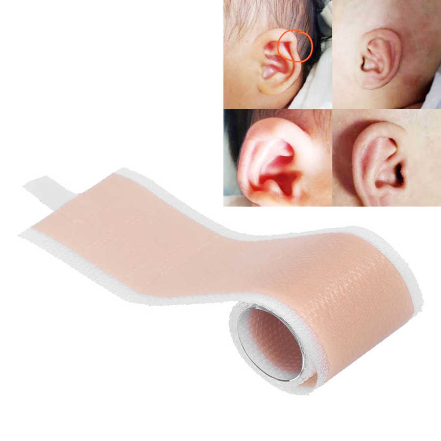 4 x 50cm Silicone Newborn Baby Ear Aesthetic Correctors Kids Infant Protruding Ear Patch Stickers